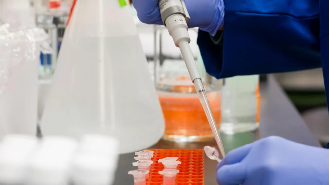 What genetic disorders are ass